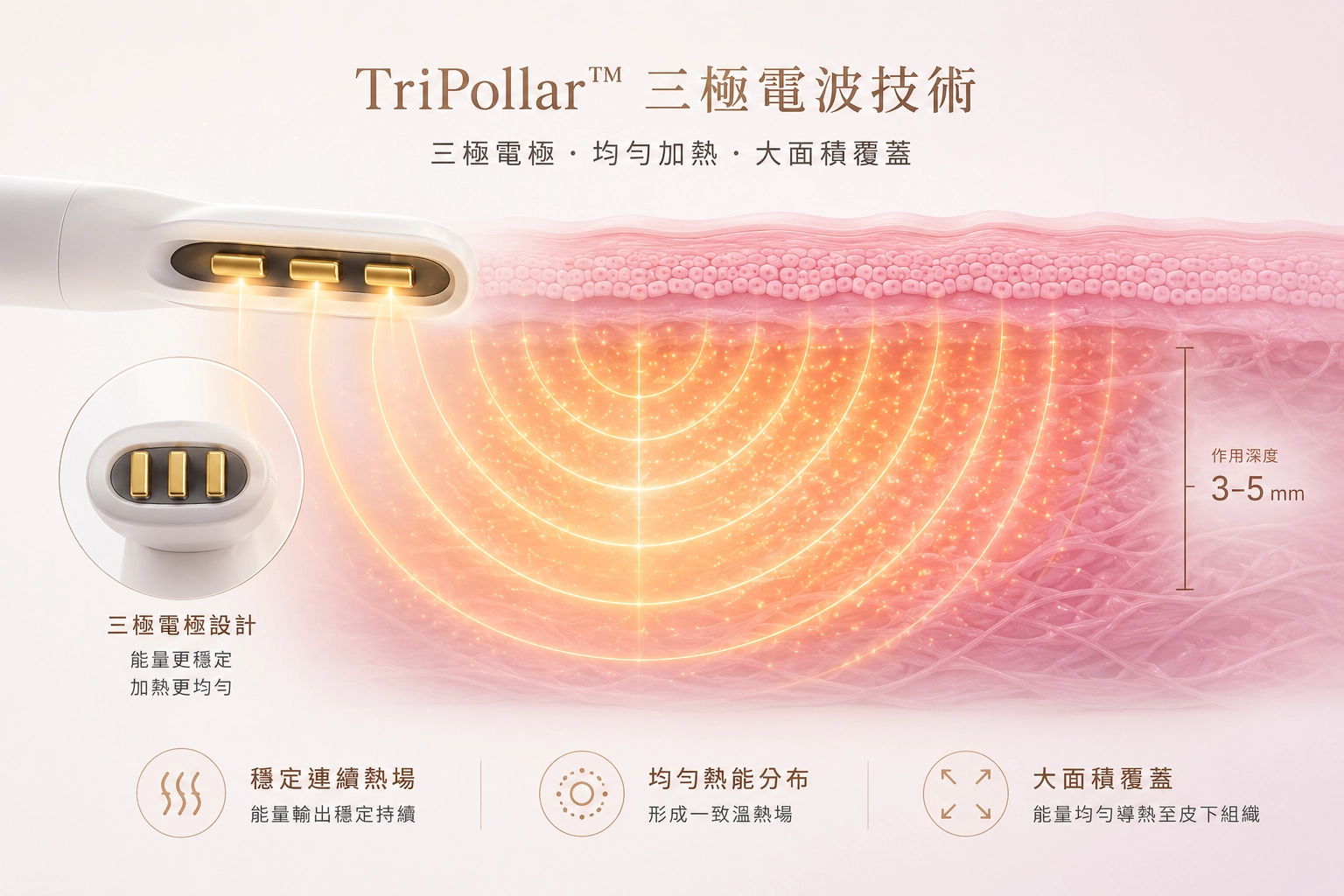 蝴蝶電波 4 蝴蝶電波 TriPollar 三極電波技術示意:三極電極均勻加熱,作用深度 3 至 5 mm