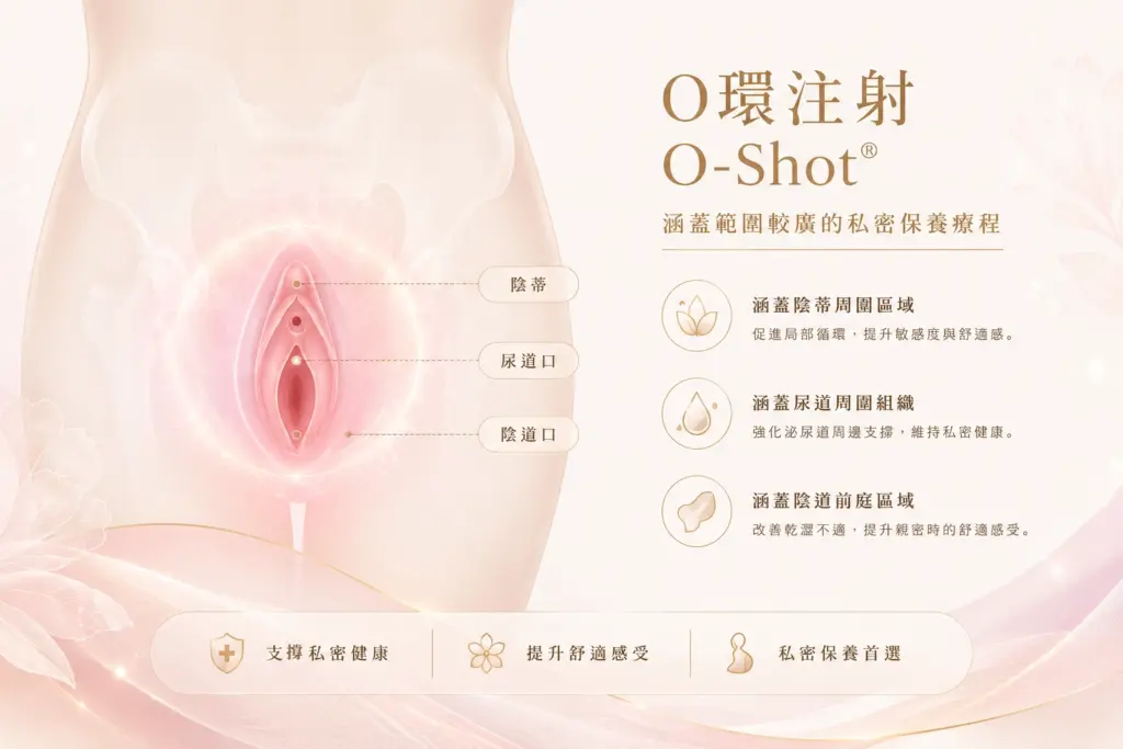 O-Shot 私密注射部位示意圖，標示陰蒂、尿道口與陰道口